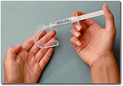 whitening gel