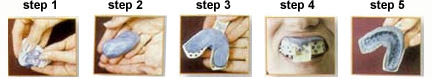 teeth whitening instructions
